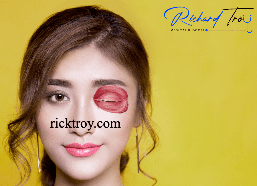 Spock eyebrows after Botox: how to fix? - Richard Troy